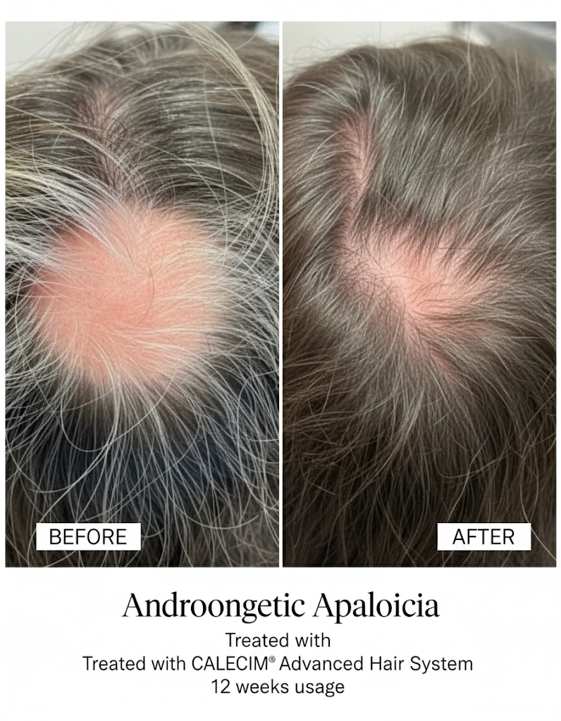 PTT-6 hair treatment PTT-6 hair treatment